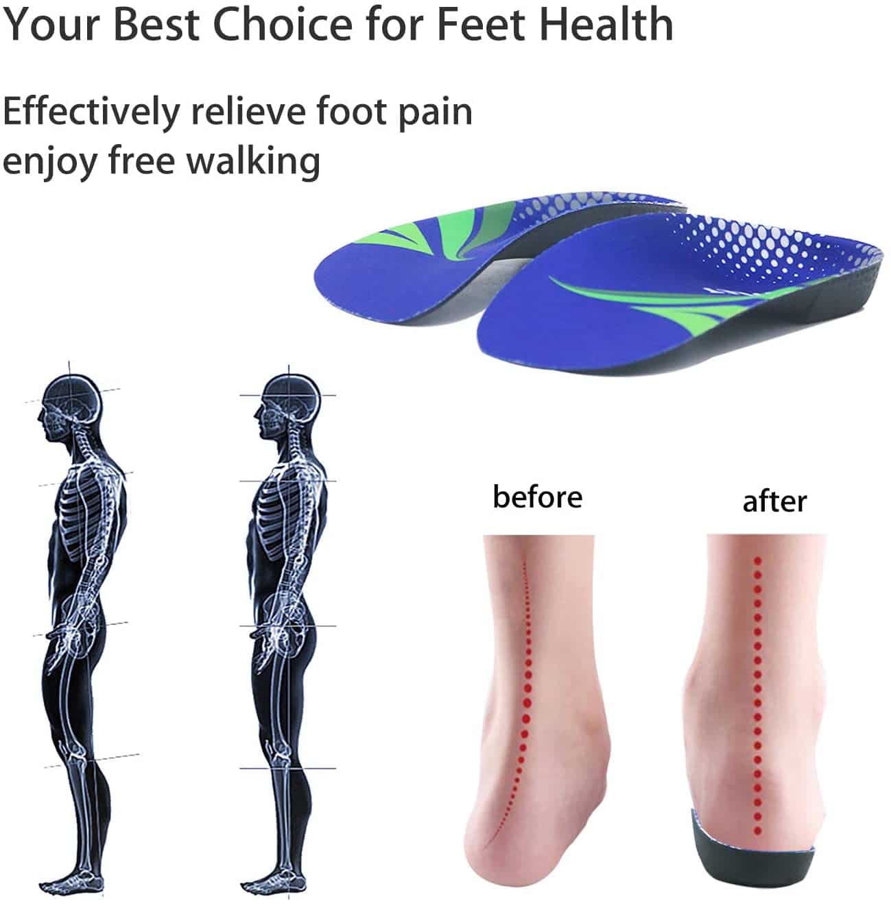 Top 10 Best Insoles For High Arches Reviews Best Orthotics For High