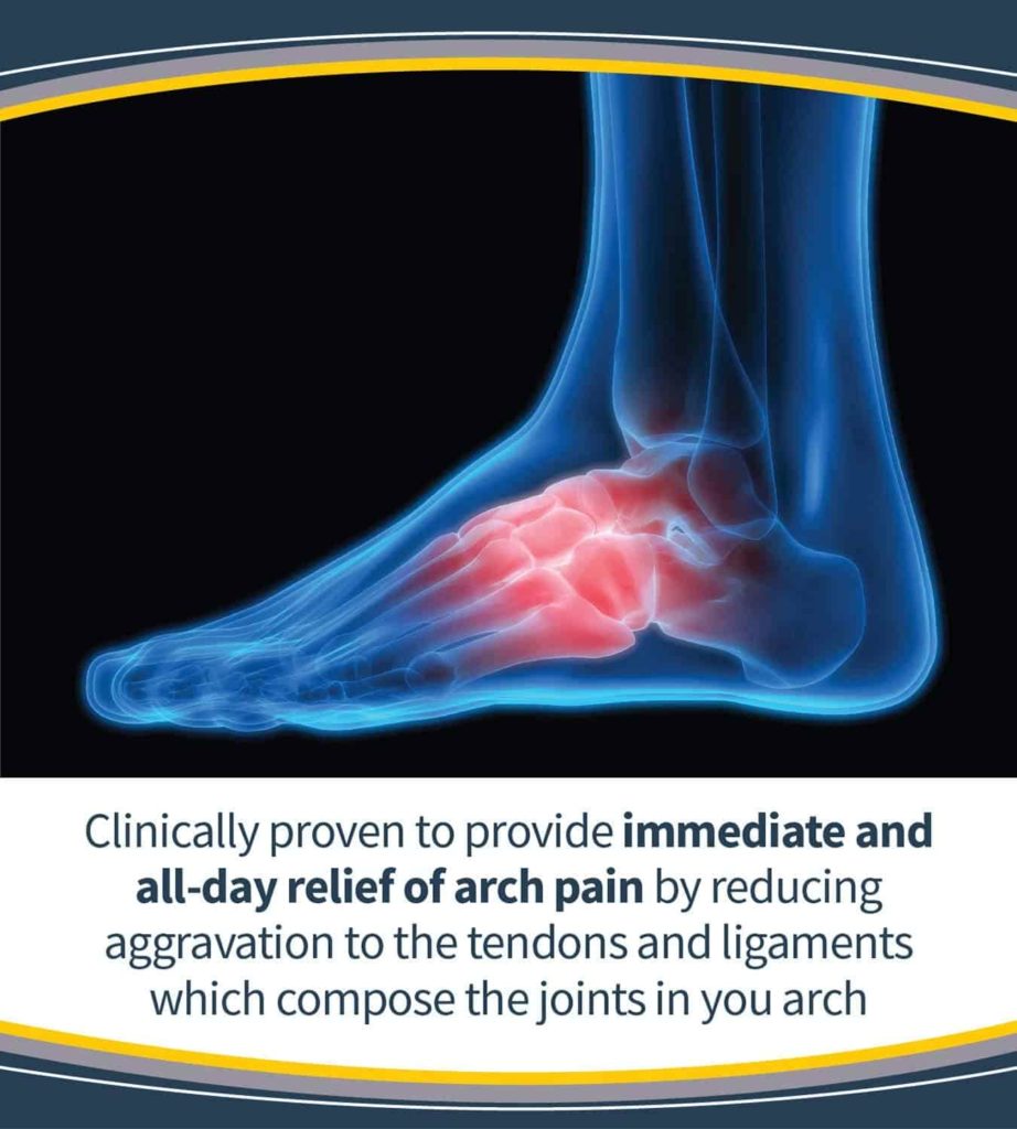 Causes of High Arches